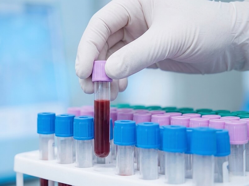 Какие анализы помогают выявить паразитов